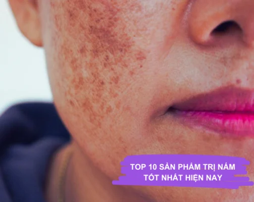 TOP 10 MỸ PHẨM TRỊ NÁM TỐT NHẤT HIỆN NAY