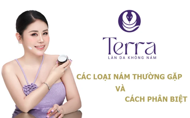 Các loại nám da thường gặp và cách phân biệt - Terra