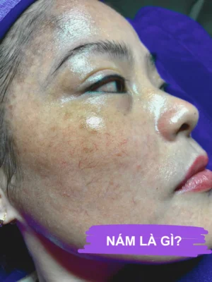 Nám là gì? -Terra