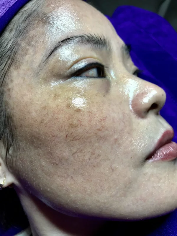 Hình ảnh về nám - terra