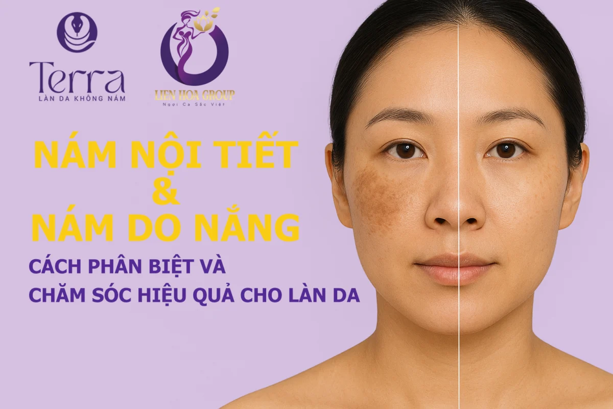 Nám Nội Tiết Và Nám Do Nắng: Cách Phân Biệt Và Chăm Sóc Da Hiệu Quả